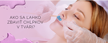 Ako sa ľahko zbaviť chĺpkov na tvári